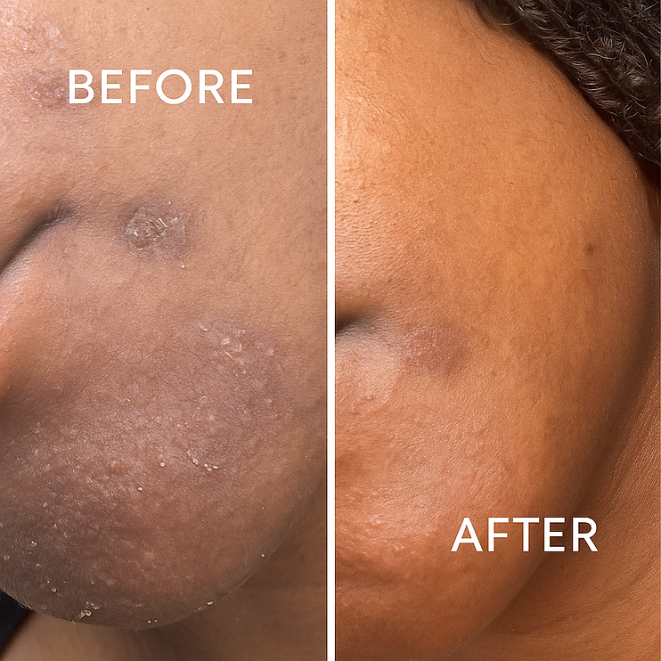 Turmeric Brightening Bar