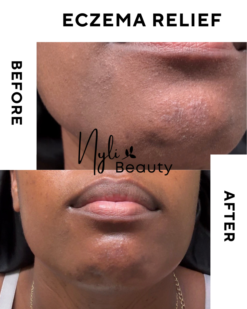 Turmeric Skin Repair Starter Kit