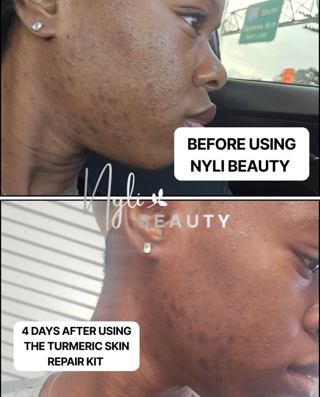 Turmeric Luxe  Kit | Face + Body