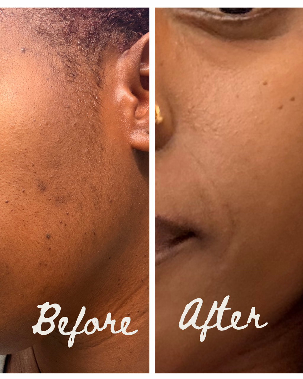 Turmeric Glow Cleanser | Face + Body