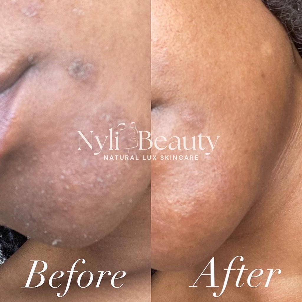 Turmeric Brightening Scrub image 1