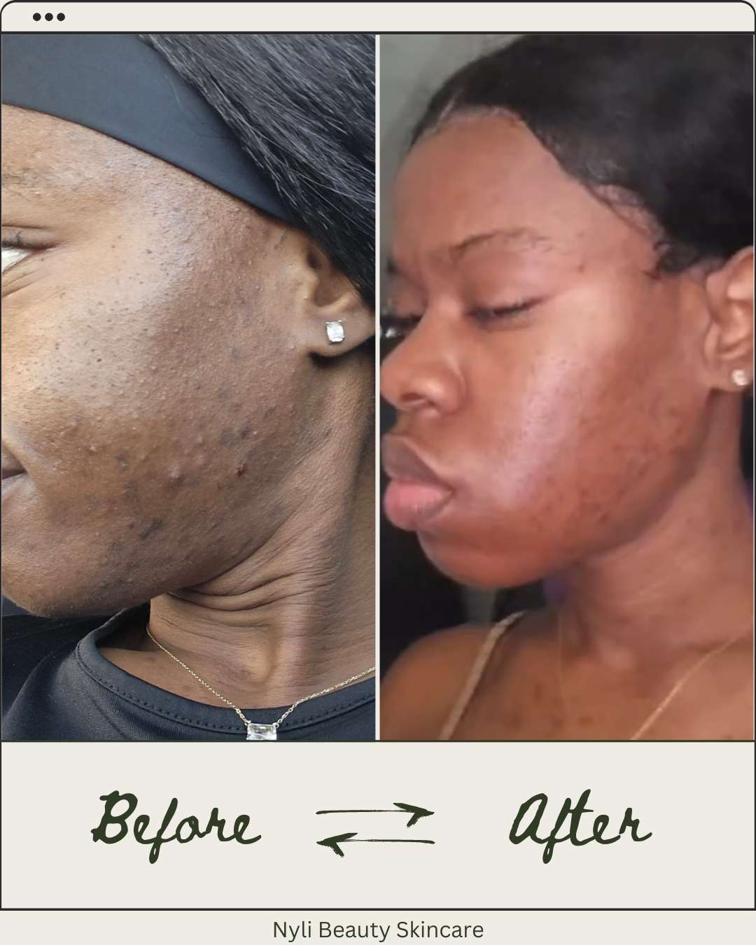 Real Nyli Beauty customer skincare results