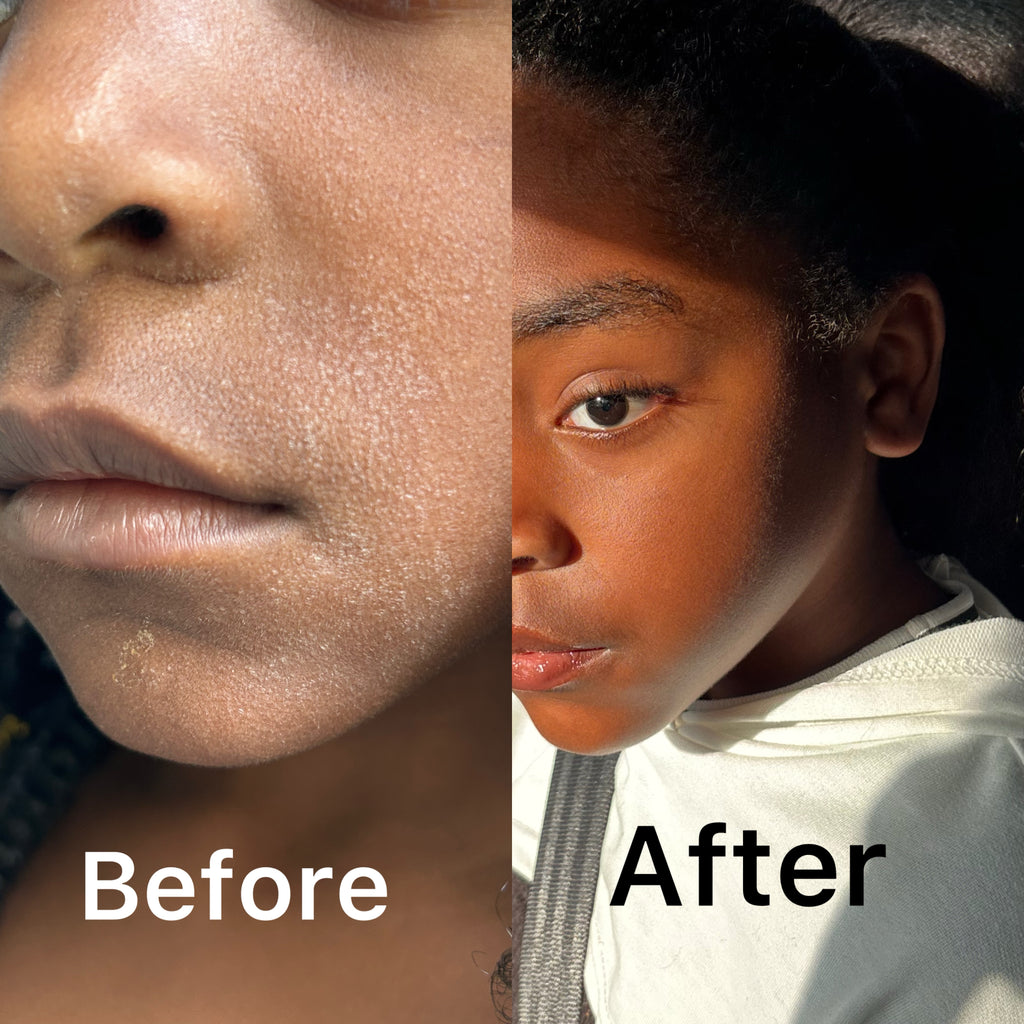 Turmeric Skin Repair Starter Kit