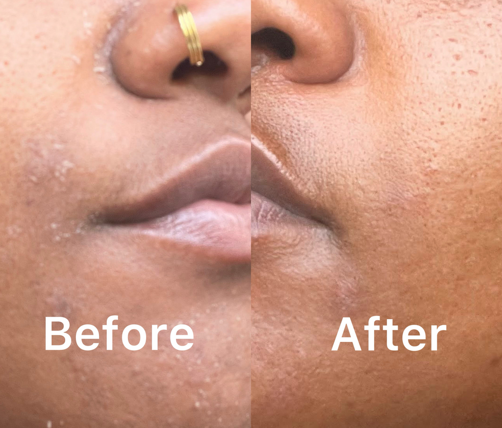 Turmeric Skin Repair Starter Kit